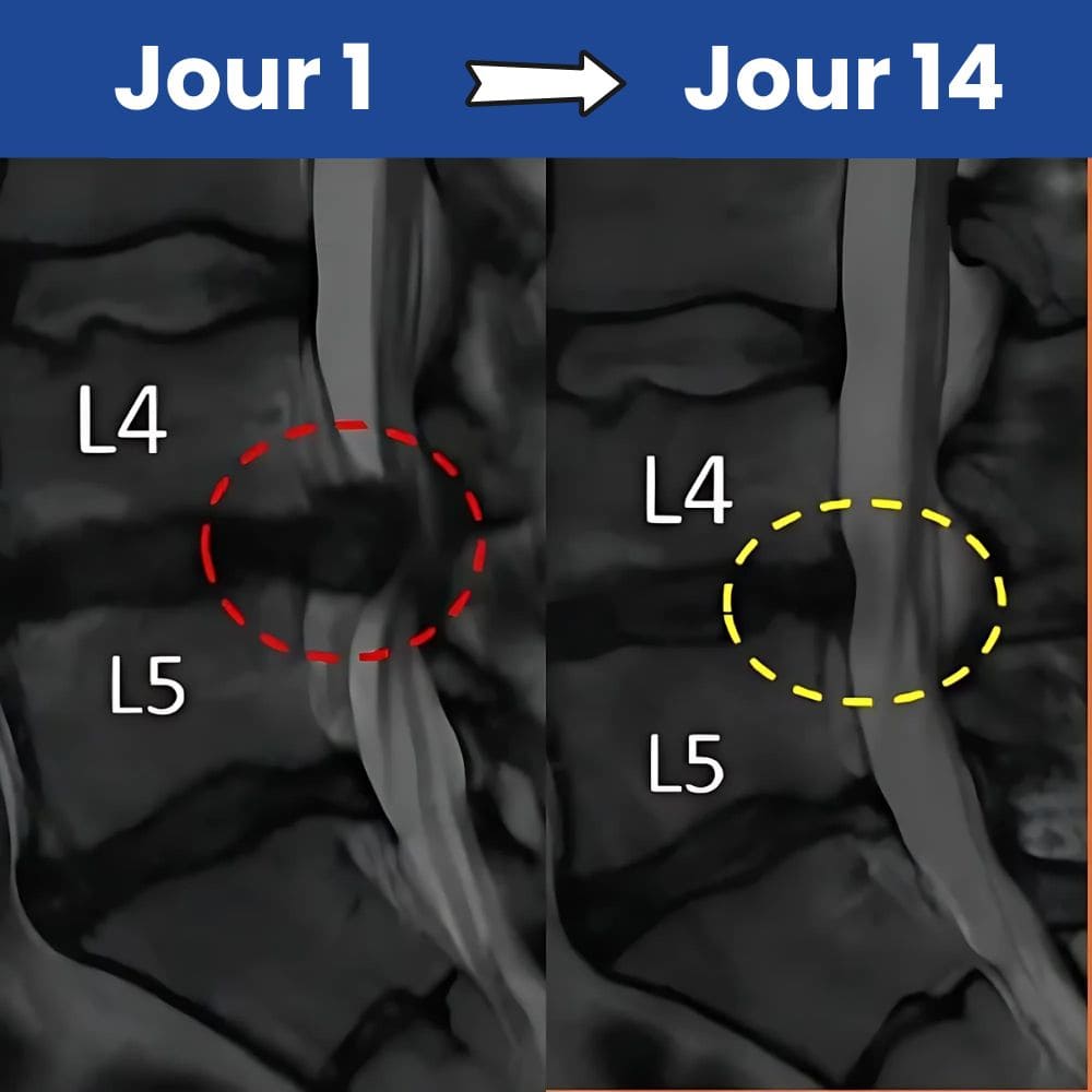 Ceinture SciatiFIX™