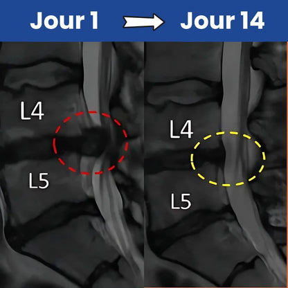 Ceinture SciatiFIX™